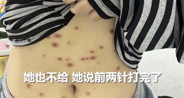 宠物市场隐忧曝光;18岁女生购猫后染病,商家责任引热议。 健康养生